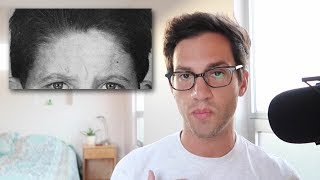 The Misunderstood Role of DHT in Male Pattern Baldness