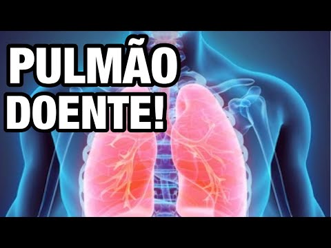 5 Symptoms of Lung Disease 🫁