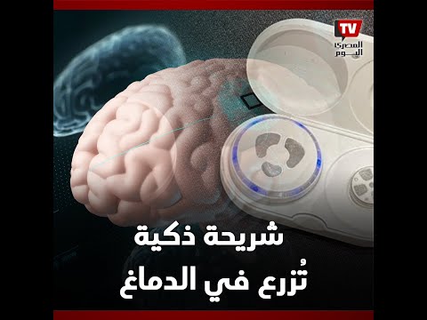 لعلاج الاكتئاب وتحسين المزاج.. اختراع شريحه تزرع في الدماغ