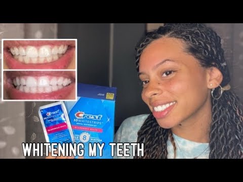 Testing Crest 3D Whitening Strips | 10 Day Honest Review