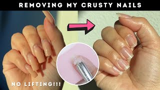 How to remove 5 week old Gel X Nails at home 😳 *cheap & easy removal*