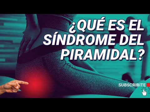 WHAT IS PIRIFORMIS SYNDROME? DIAGNOSIS AND TREATMENT