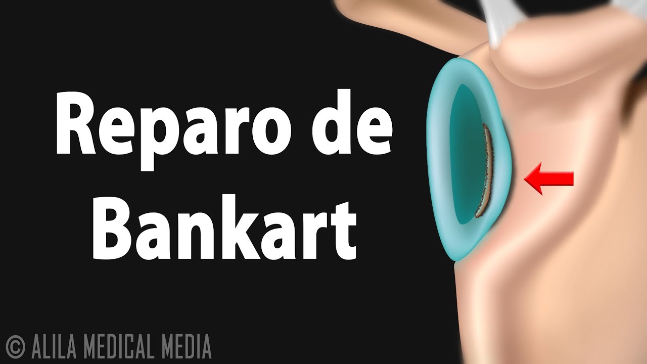 Marcus Vinicius Santos Martins-11