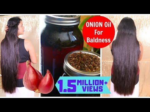 Onion Oil For Treating Baldness & Gray Hair | Grow Super LONG HAIR  | Sushmita's Diaries