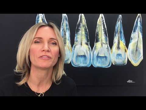 Myth: Invisalign can't move crowded teeth