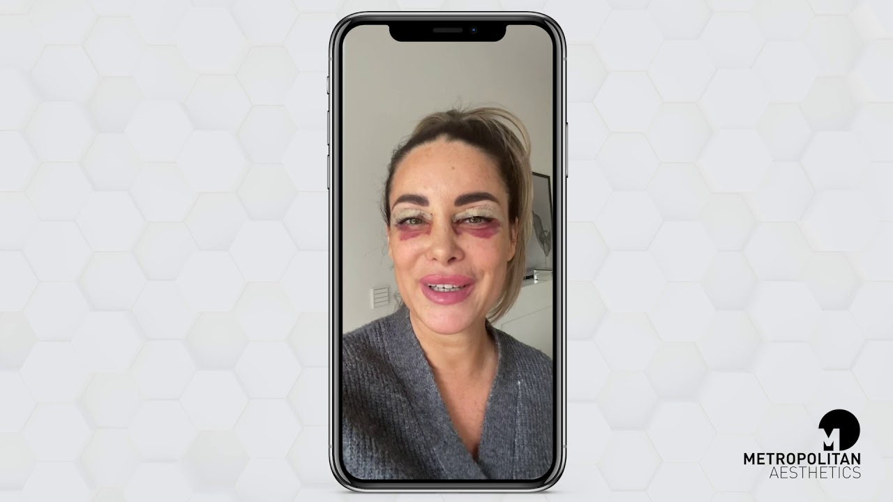 Christian Roessing-8