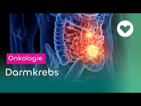 Darmkrebs - Symptome, Diagnose und Behandlung