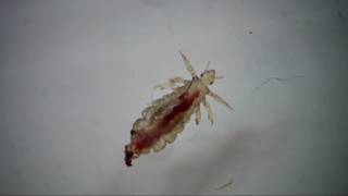 Try to watch without scratching your head. Head lice and nits under a digital microscope.