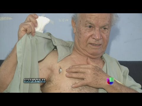 ¡Esto es el colmo!, a un hombre se le sale el marcapasos del pecho - Primer Impacto