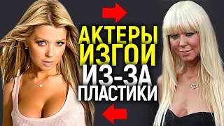 ПРОСТО МРАК...ЗВЕЗДЫ ГОЛЛИВУДА, СТАВШИЕ ИЗГОЯМИ ИЗ-ЗА НЕУДЧНОЙ ПЛАСТИКИ!