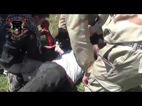 أحد جرحى عناصر لواء أسود الإسلام في معركة السيطرة على قرية جدية في ريف درعا