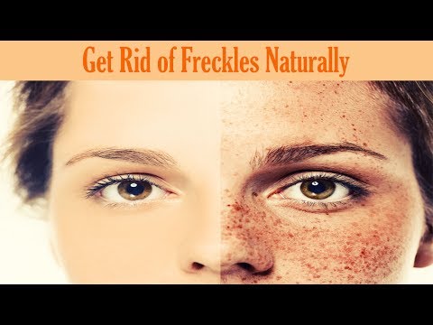 How to Get Rid of Freckles Naturally and Fast...