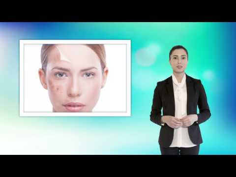 Il pigmentary nota allendocrinologo Il pigmentary nota su un corpo della ragione e un trattamento di una fotografia di vitiligo