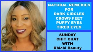 NATURAL REMEDIES FOR DARK CIRCLES, EYE BAGS PUFFY EYE AND CROWS FEET