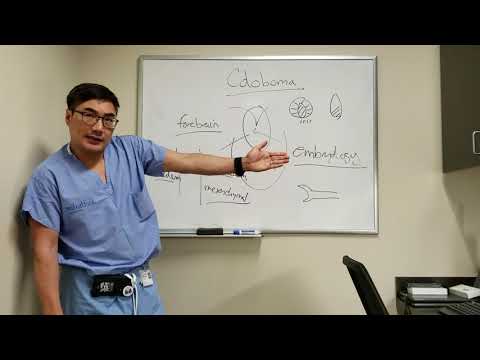 Coloboma - YouTube