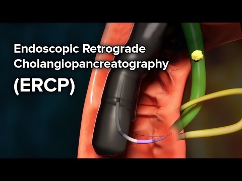 Pediatric ERCP | Cincinnati Children's