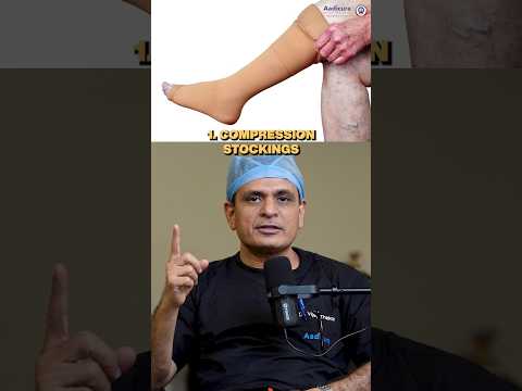 5 best ways to treat varicose veins.