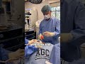 Gynecomastia Surgery Before And After Drcaridi Menshealth Chestworkout Bodytransformation