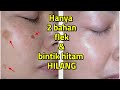 CARA CEPAT HILANGKAN FLEK HITAM CARA MENGHILANGKAN FLEK HITAM DI WAJAH