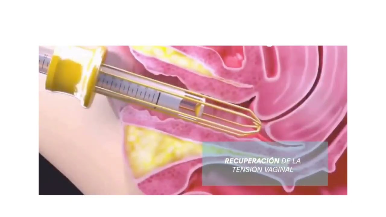 Iván Jiménez Martínez-21