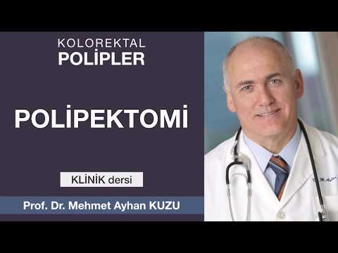 Kolorektal Polipler - Polipektomi