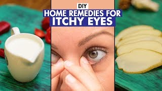 Home Remedies For Itchy Eyes   DIY   Fit Tak