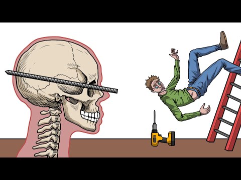 The Luckiest People Who Survived The Impossible