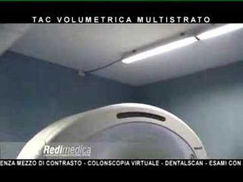 Dolore durante la gravidanza iniziale Danza terapia per il trattamento di ernia discale lombare della