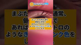 まぶたの裏を医師が確認する理由って知ってる？ / サマ記事 Media NEWS