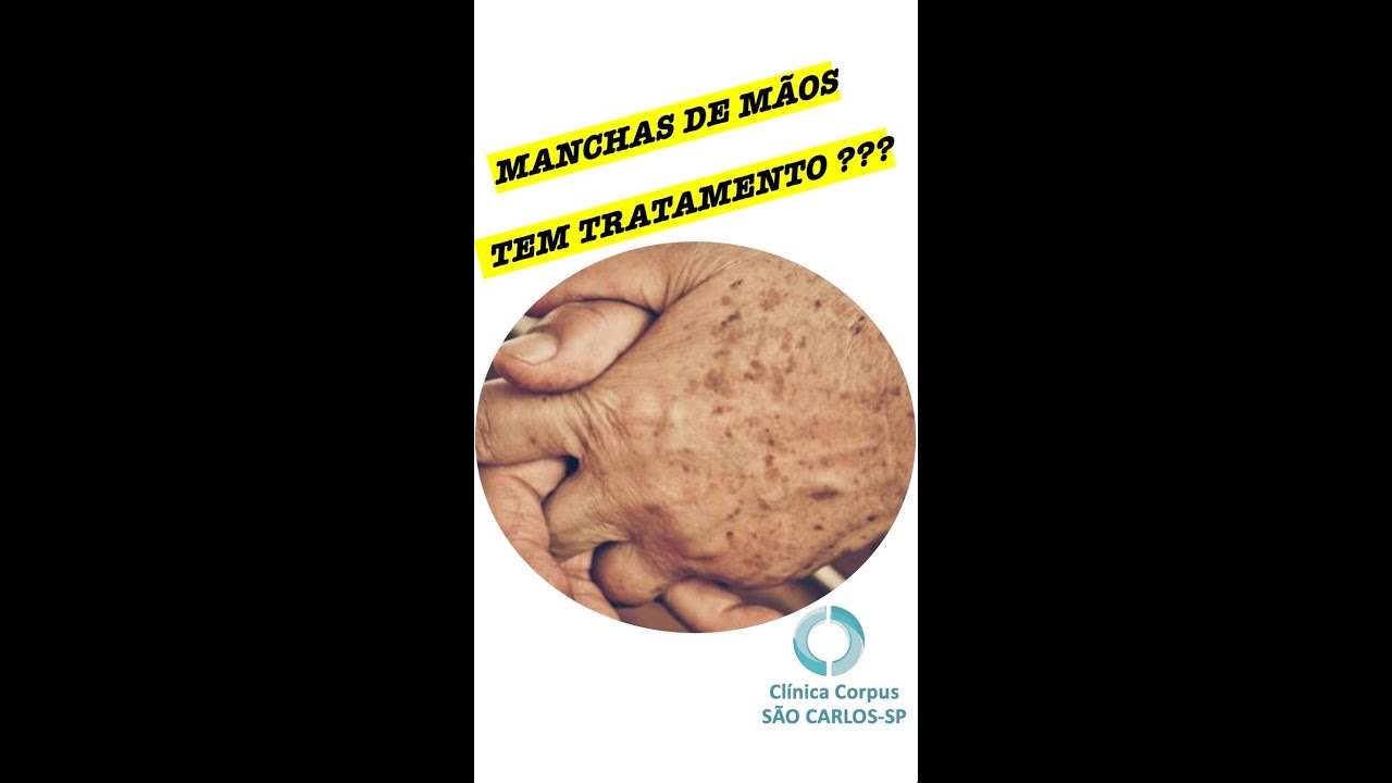 Moyses Costa Lemos-75