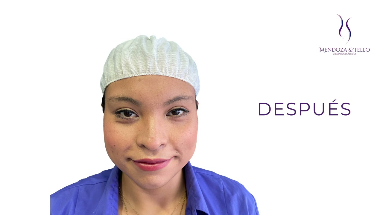 Alexander Mendoza-96