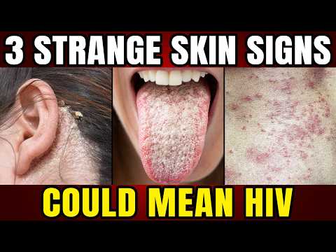 3 HIV Warning Signs People Ignore