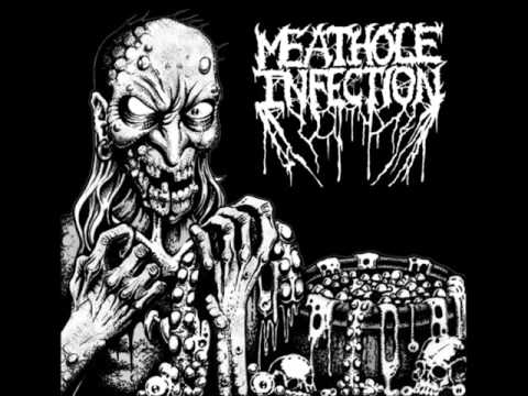 Meathole Infection-Pulsating Sores