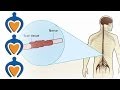 Multiple Sclerosis MS What Is Multiple Sclerosis