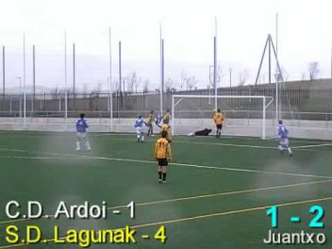 Ardoi 1 - Lagunak 4