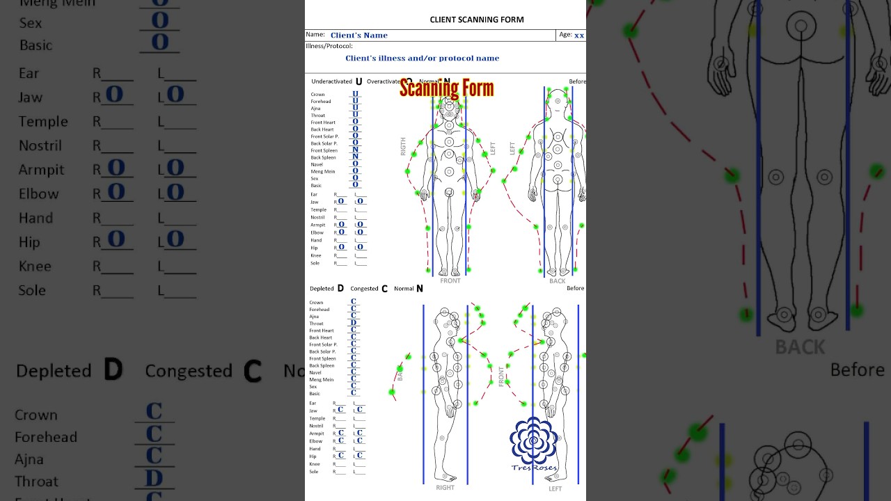 Downloadable Pranic Healing Scanning Form     #pranichealing #energyhealing
