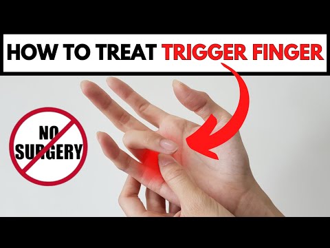 How To Treat Trigger Finger Without Surgery