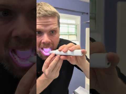 Tartar and plaque removal tool. I especially like the light on this thing.