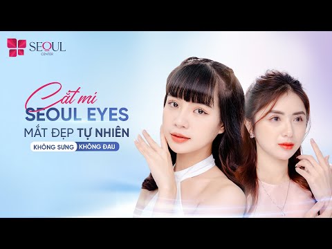 Cảm Nhận Thế Nào Sau Khi Cắt Mí Mini Seouleyes