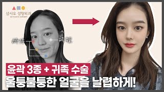 울퉁불퉁 비대칭 얼굴... 윤곽 3종 + 귀족 수술로 셀카 여신!_[삼사오 성형외과]