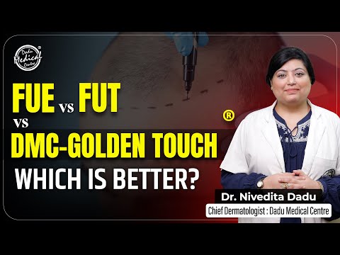 Hair Transplant Techniques: FUE vs FUT vs DMC-Golden Touch®
