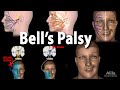 Bell's Palsy, Pathophysiology, Symptoms, Diagnosis and Treatment, Animation