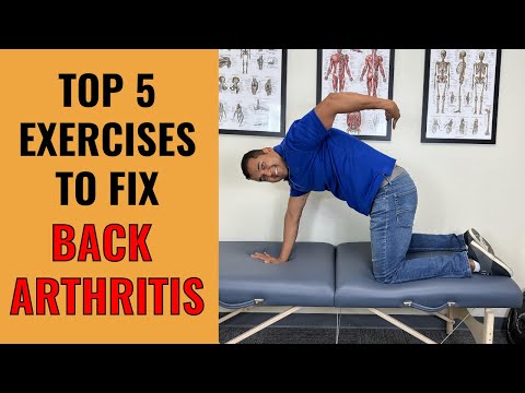 Top 5 Essential Exercises You Need To Help Fix Back Arthritis