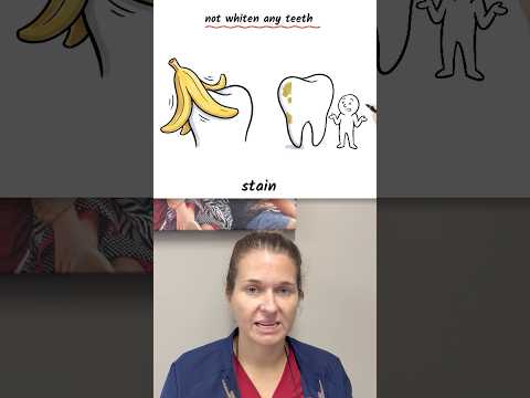 Amber-Lee, registered dental hygienist, explains whether a banana peel whitens teeth at Bright White Dental Hygiene Clinic in Riverview NB