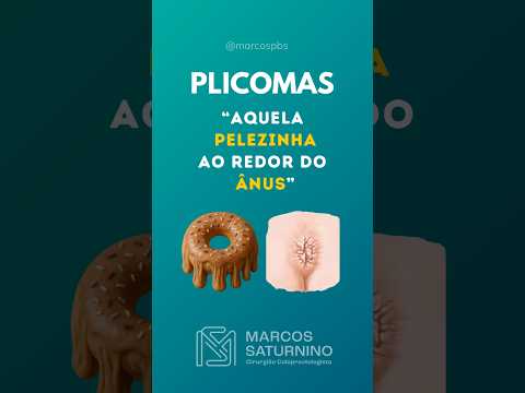 Marcos Saturnino-6