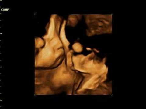 Ultrasound Babies 2007-01-04 #1
