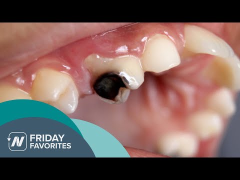Friday Favorites: How to Stop Tooth Decay（Friday Favorites: How to Stop Tooth Decay）