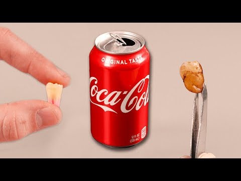 I Put a Tooth In Coca Cola For 24 Hours