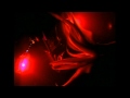Giant Squid Attack