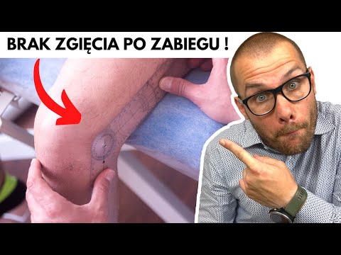 NO FLEXION AFTER KNEE ARTHROSCOPIC? - Is it adhesions (arthrofibrosis)? - PRACTICE IT!